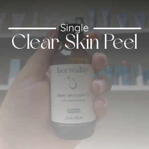 Clear Skin Peel (Single Treatment)