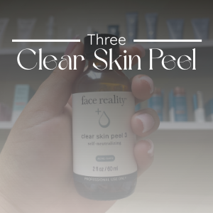 Clear Skin Package (3 Treatments)