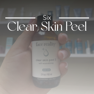 Clear Skin Package (6 Treatments)